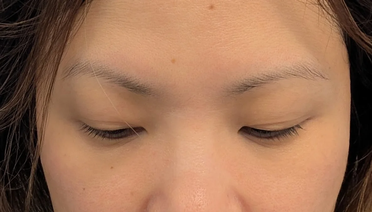 Close-up of sparse eyebrows